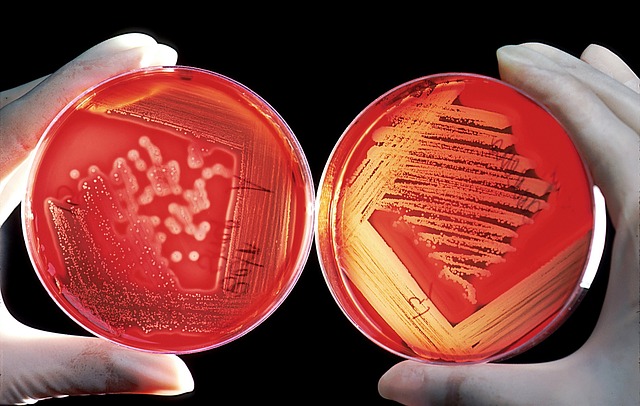 Bei Haustieren gefundene arzneimittelresistente Superbakterien können sich auf den Menschen übertragen, warnt eine Studie